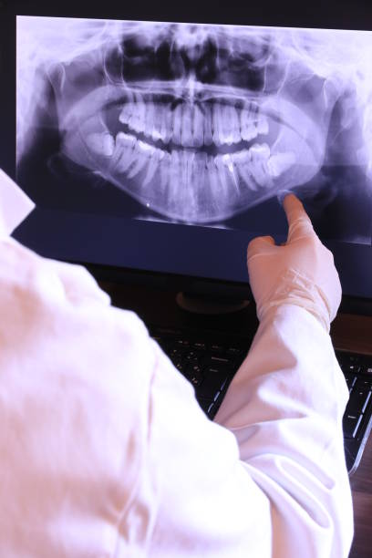 Best Emergency Dentist for Lost Fillings or Crowns in Kilauea, HI